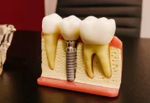 piotrowscybejnarowicz.pl - 037-jak-wyglada-zabieg-implantacji-natychmiastowej-w-gliwicach.webp