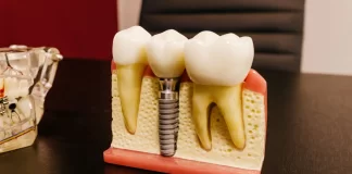 piotrowscybejnarowicz.pl - 037-jak-wyglada-zabieg-implantacji-natychmiastowej-w-gliwicach.webp